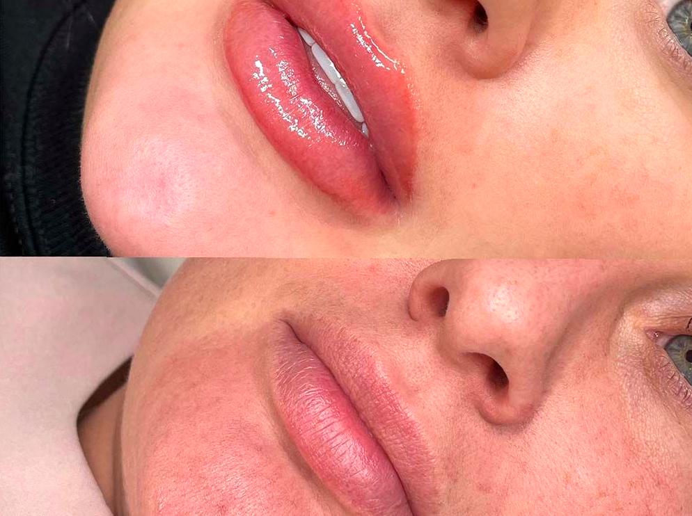 Understanding the Expense of Lip Tattoos