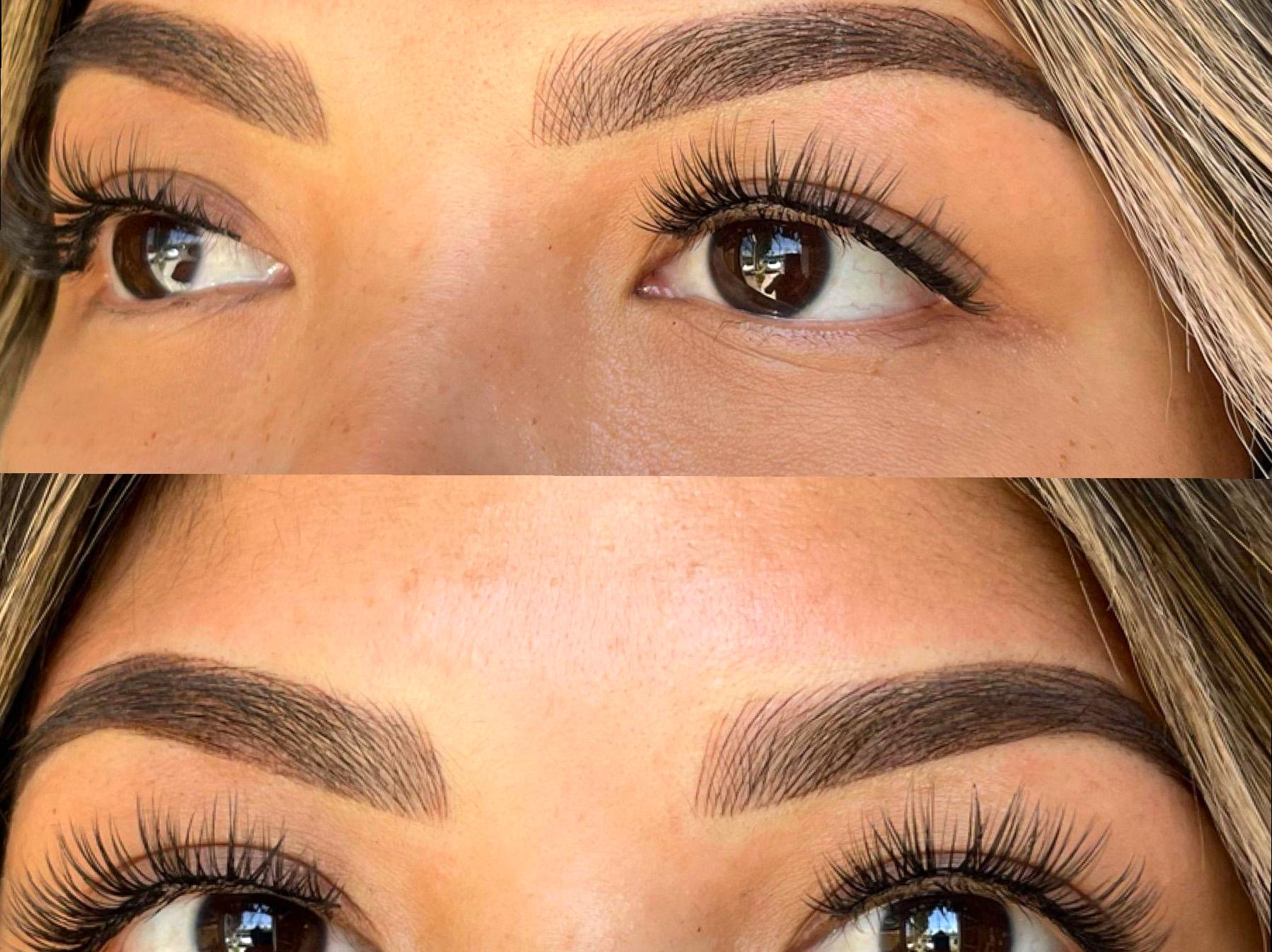 Recovery Process for Combination Eyebrow Techniques