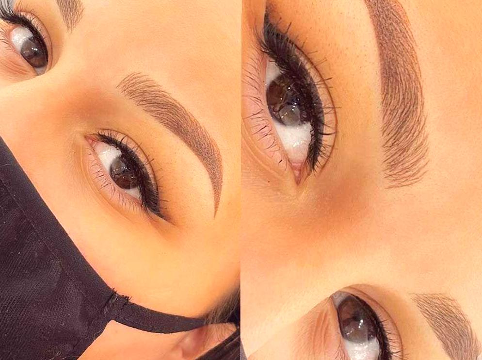 Combination Eyebrow Recovery Timeline